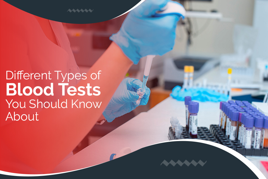 Different Types of Blood Tests You Should Know About