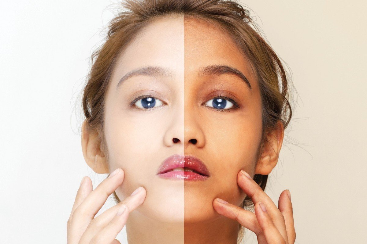 Advantage and Disadvantage of Bleaching Powder