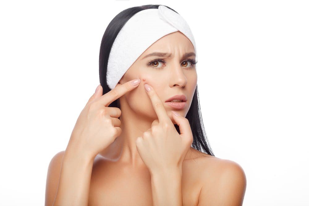 4 Top Rated Laser Treatments For Treating Acne Scars