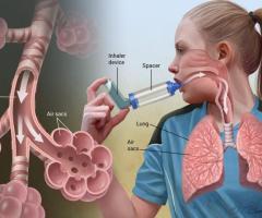 The Best Homeopathic Treatment For Asthma