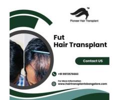 Fut Hair Transplant in Bangalore-Pioneer